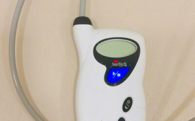 Kmat -holter krvnog tlaka